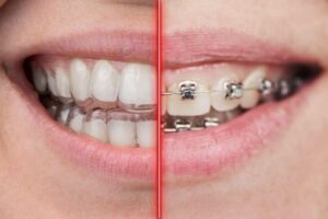 Orthodontie